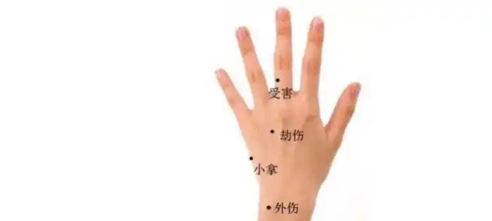 手背痣相图解手背痣出现这几个痣