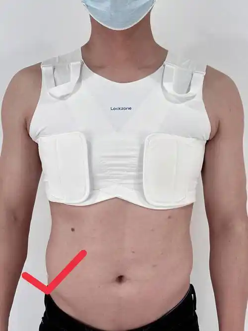 防止并发症:开胸手术后绑带的关键作用_患者_胸部_伤口