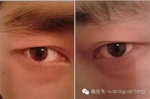 羊虽然温顺,但是如果某个人眼睛像羊眼那就不是什么好事了.