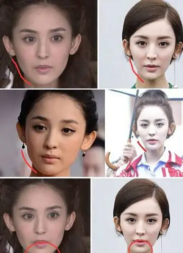 "话题女王"古力娜扎整容前后 古力娜扎整容大变脸