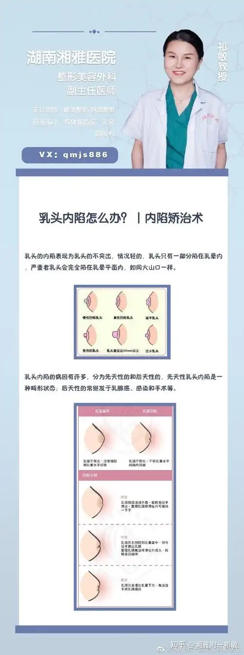 乳头凹陷怎么办内陷矫正术