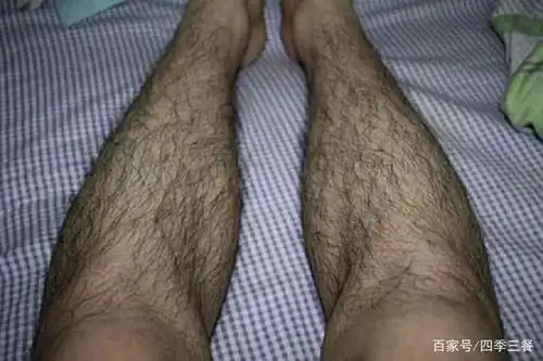 有的男生腿毛浓密,有的男生腿毛却很稀疏,听听专家科学解释