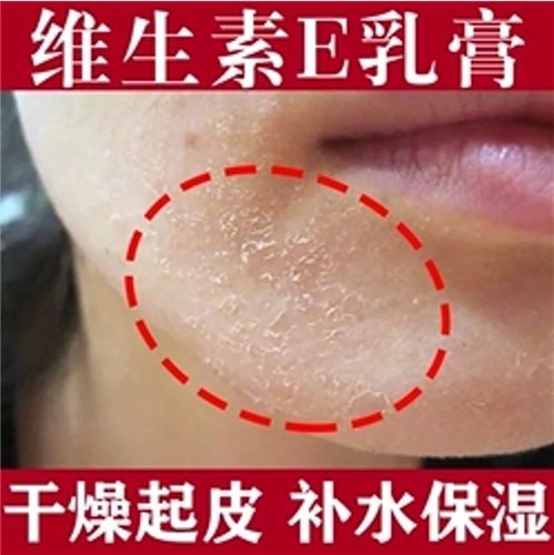 脸上皮肤脸干燥起皮痒脱皮干皮脸部面部下巴保湿补水男女过敏红痒