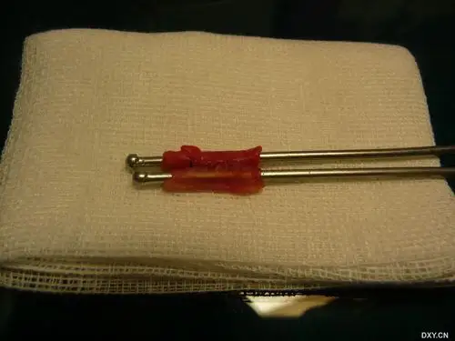 【争鸣】猪血管的侧侧吻合