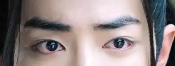 眼睑下至能做吗