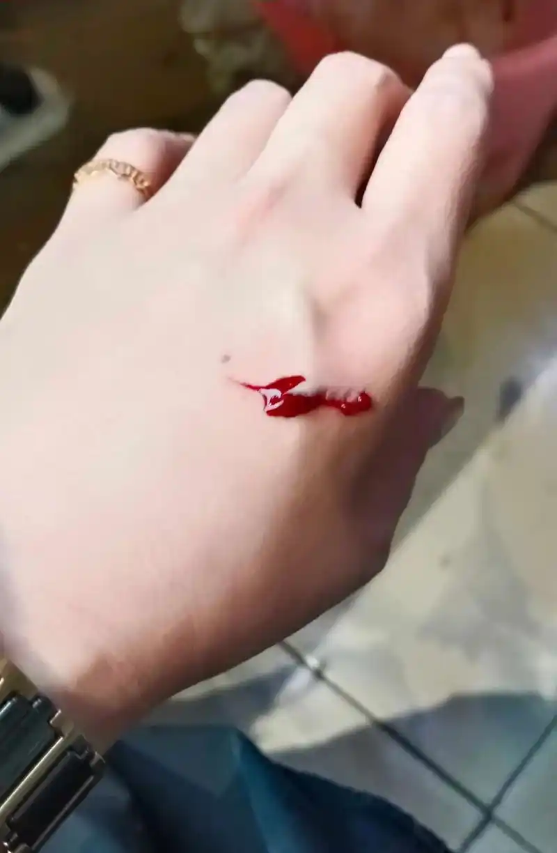 俗话说:见血破灾了,但愿是个好兆头,一不小心就割伤了手,虽然疼
