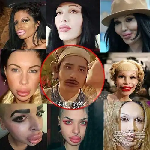 惊悚的面部表情惊呆网友,顶着这样一张脸很难让人不怀疑是整容失败