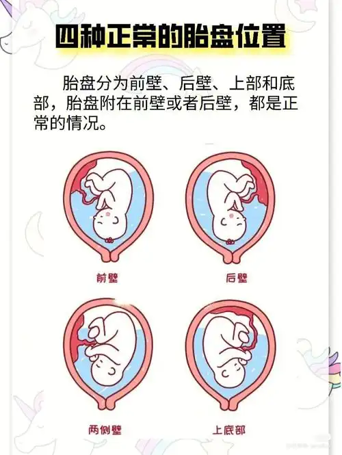 离宫颈内口近一点,这就是胎盘低置;96妊娠28周后,胎盘下缘达到或