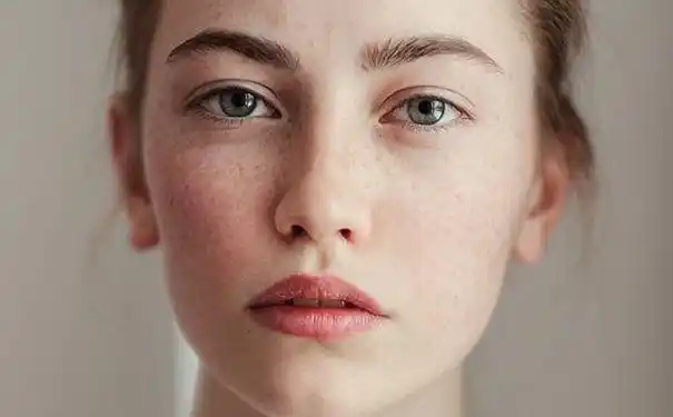 45岁女子用3个月成功淡化黄褐斑分享4个经验皮肤干净白嫩