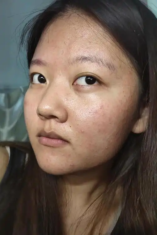 姐妹们有没有和我一样垃圾的皮肤我这样的还能怎么做呀