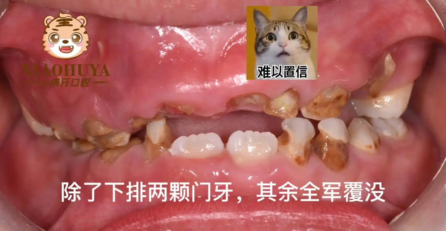 孩子看牙来小虎牙 2019年3月～至今 历经3年,每3个月 - 抖音