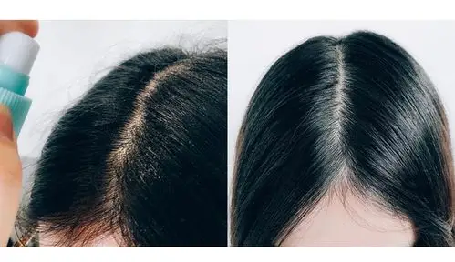 「发际线拯救神器」明星推荐 日本柳屋头皮滋养液240ml/瓶 发根营养液