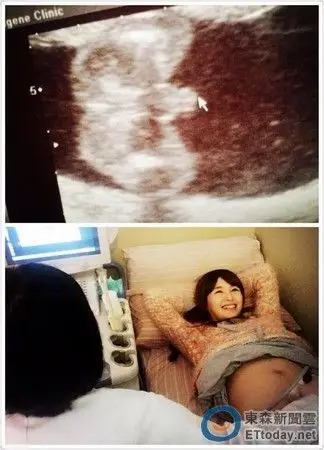 林舒语公开肚中宝宝性别 害羞笑到头发都分岔了!