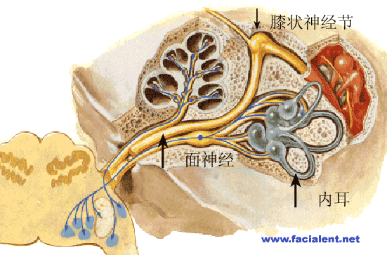 预后:此病预后比贝尔氏面瘫差,自愈的患者不及30%,大部分患者通过保守