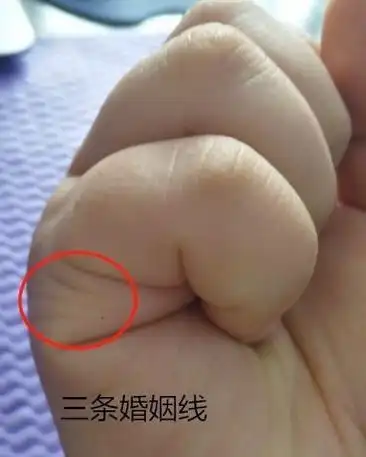 快数数你有几条婚姻线?