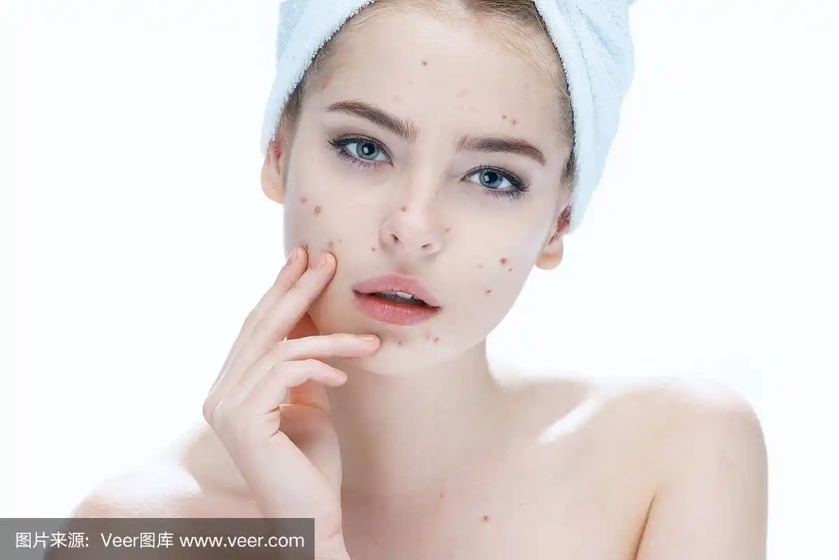 丑陋的问题皮肤女孩.女性护肤理念