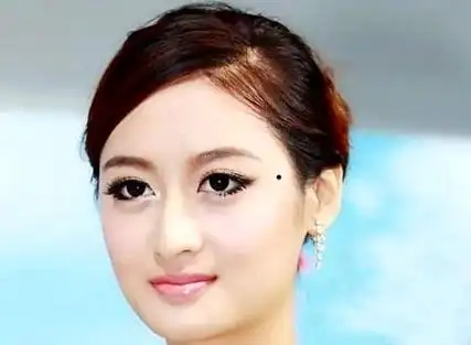 女人脸上哪些痣不能动 点掉之后失去富贵命