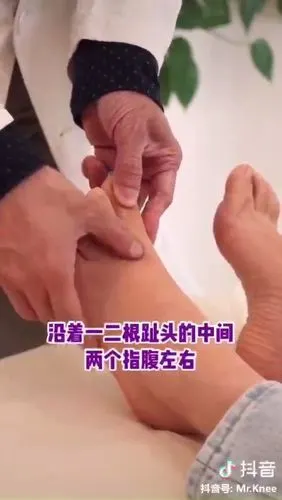 【 拇外翻自我锻炼及按摩方法】夏天又到了露脚趾的时候, 走在大街上