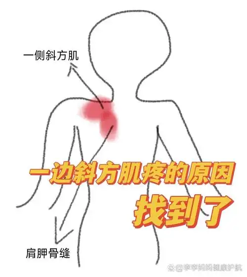减轻某一侧斜方肌痛的一个小方法