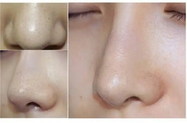 墙裂 水桥保寿堂去黑头清洁水喷雾速效控油洁肤二次清洁200ml