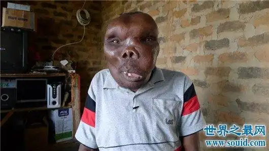 最丑男人丑陋外表无法想象 参加选秀节目成冠军_世界百科_ - mc世界之