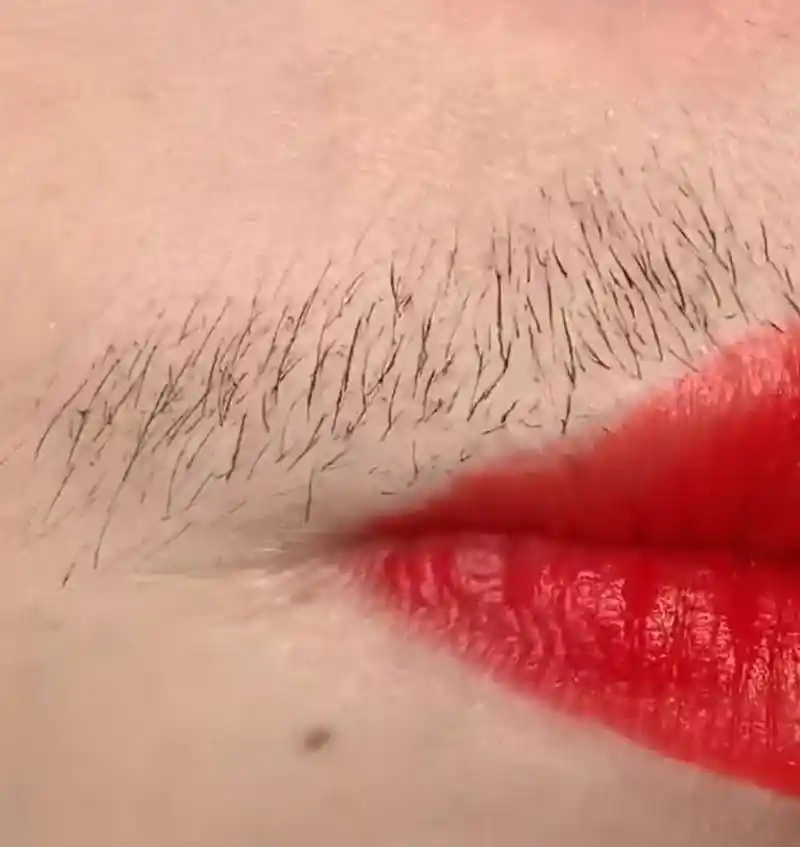 为什么有的女生嘴边也会长小胡子?到底与什么有关呢?进来看看