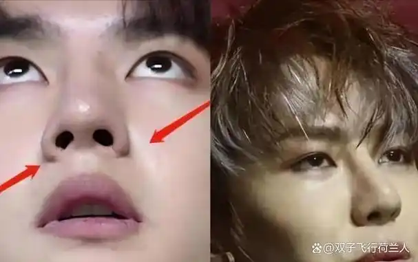 王一博新剧状态堪忧整容后遗症明显年代戏镜头里全暴露