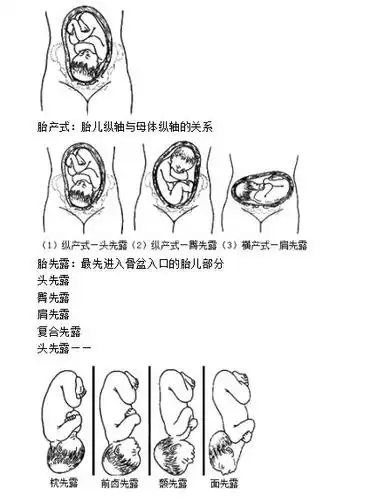 胎产式,胎先露,胎方位