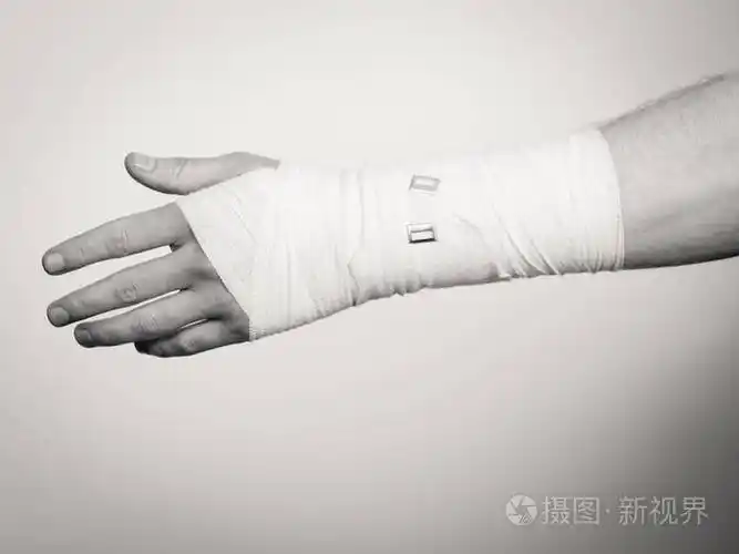 照片 骨折与脱位的概念.在白色绷带的男性手.