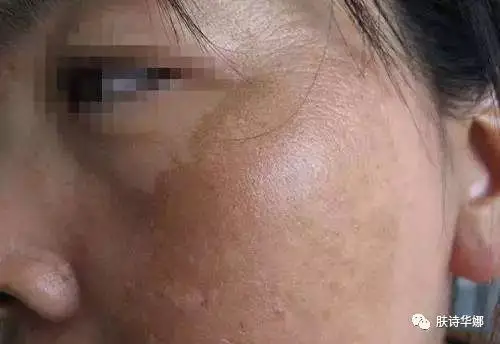 问题性皮肤终点站-小云-1522462371的美篇