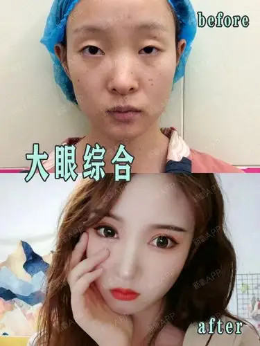 大眼部多项vs小眼部多项是丹凤眼和桃花眼的区别!