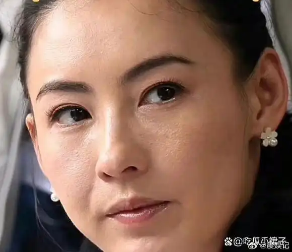 43的张柏芝,脸部肿胀,双眼凹陷,眼袋明显,穿着印花睡袍,颜值大打折扣