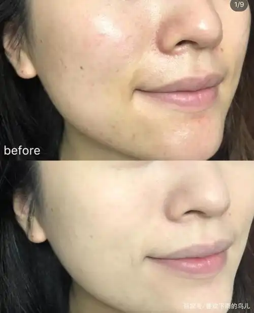 刘亦菲和陈都灵"生图"对比,谁皮肤更好,第五张图说明一切