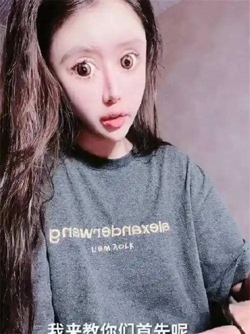 还记得13岁就赴韩国整容的女孩吗?3年整60次,如今模样让人唏嘘