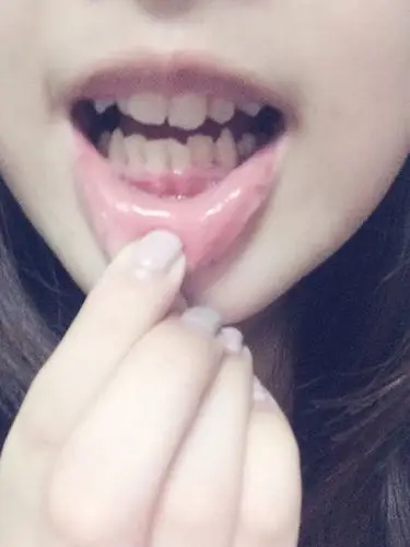 我有四只虎呀 上面两只下面两只 下面的比较尖 可是我的虎牙不是往外