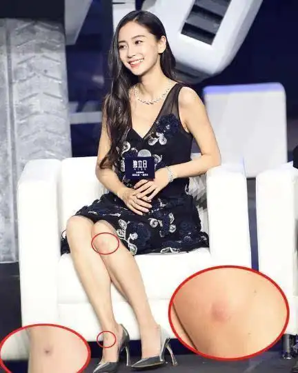 baby腿上惊现多处伤痕 网友调侃黄晓明悠着点