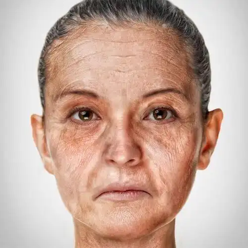 女人该怎么拯救自己的面部衰老