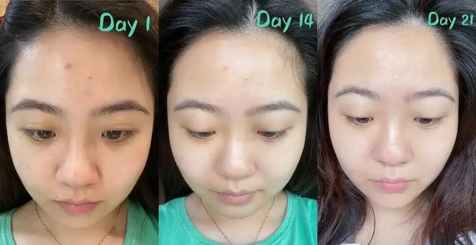 上滑看更多28天试用心得&真人对比图来自第一三共集团的传皙诺美白