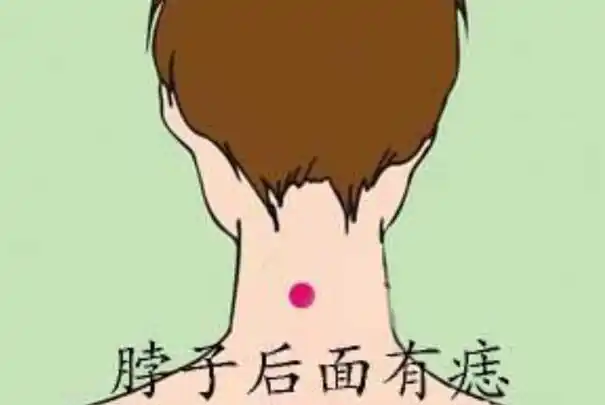 脖子后面有痣代表什么?做事有靠山和贵人为人富贵