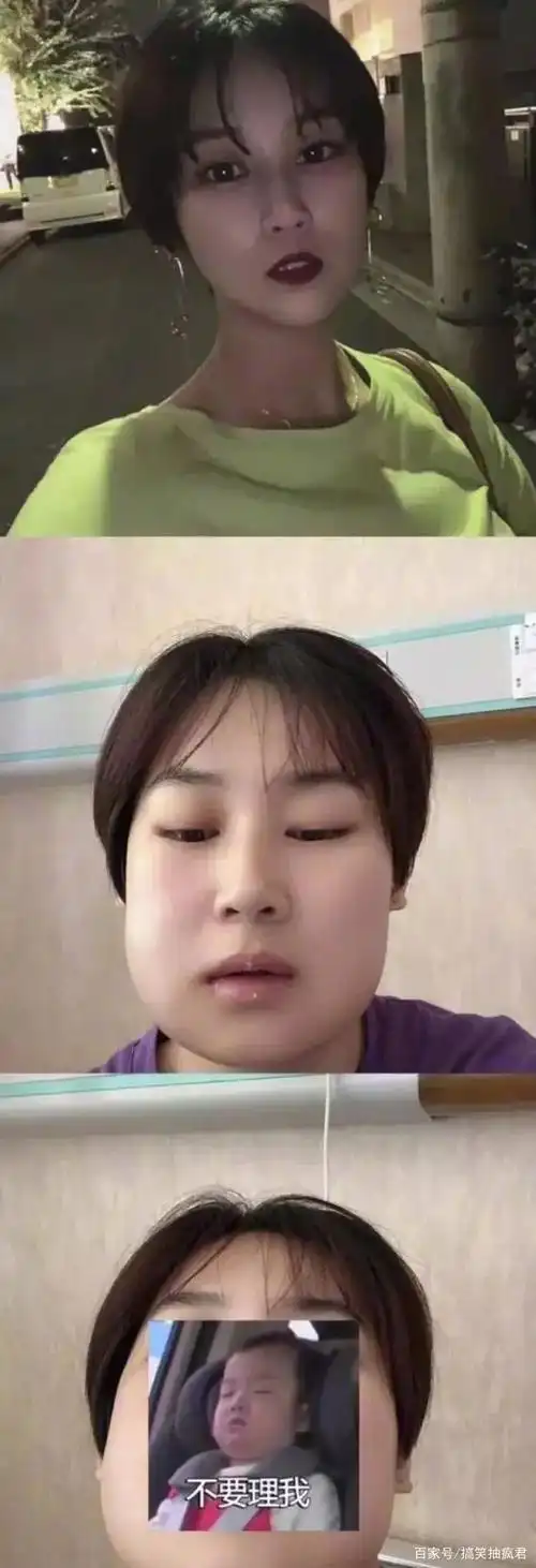 拔智齿前,妥妥的冷系美少女