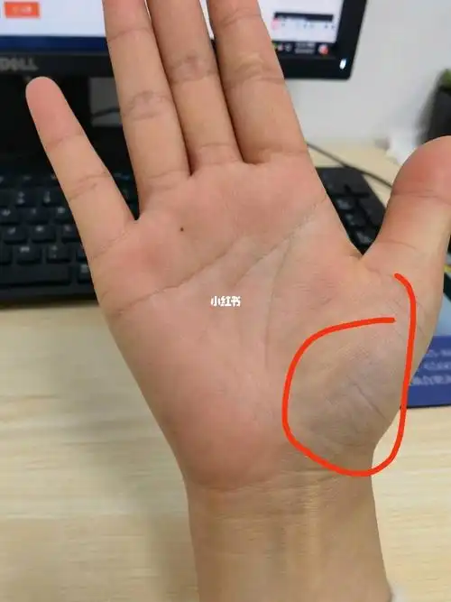 有没有知道这里发青是什么问题  两只手都有