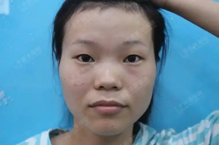 塌鼻梁大鼻子女生面相_鼻梁塌鼻子大女人_鼻梁塌的女孩命好吗