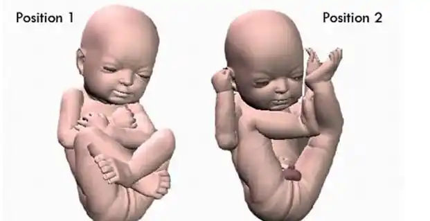 3d打印带你见未出生胎儿体位表情皮肤性别皆可见