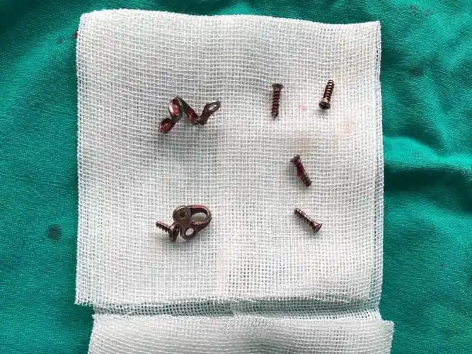 之前做下颌角手术的时候就问了一些关于手术的这些问题_圈子-新氧美容