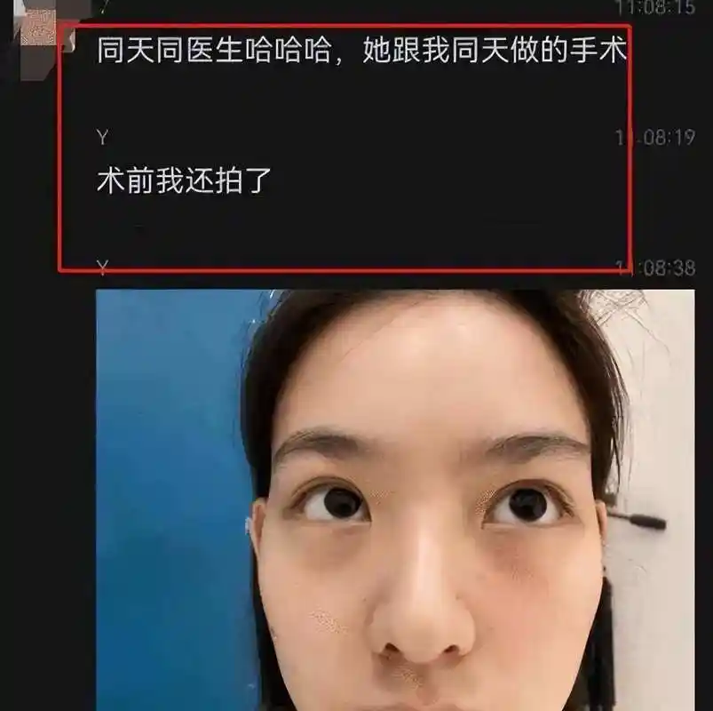 孙一宁整容素颜照疑曝光,被曝整了两个地方,对脸拍露真实颜值
