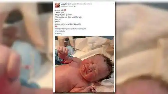 疯传70000多次!新生儿"手握"避孕环出生