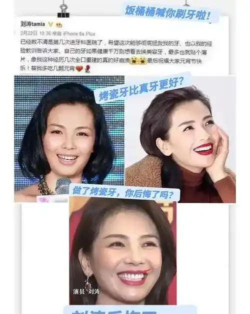 刘涛烤瓷牙上热搜,镜头前偏蓝过于夸张,疑似满嘴假牙_牙齿_形象_质疑