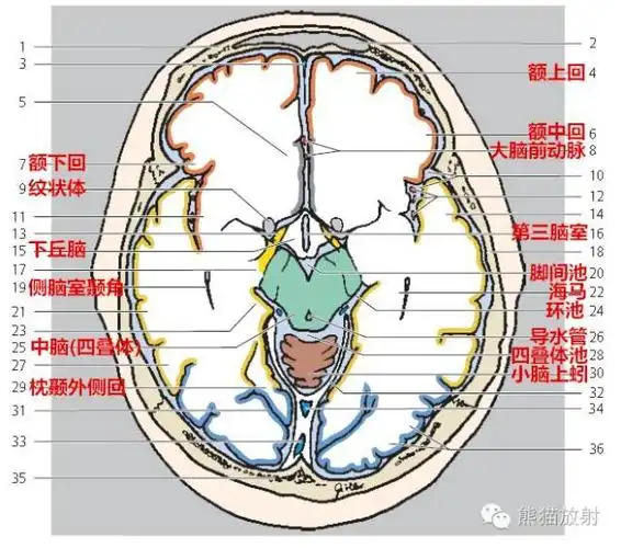 解剖入门颅脑ct断层中英文对照