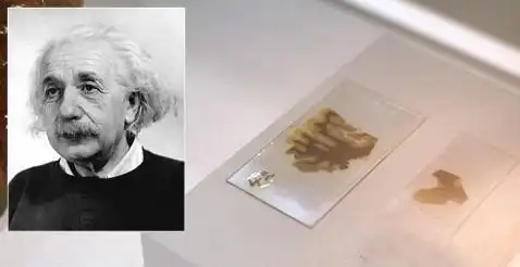 他被称为盗脑者窃取了爱因斯坦的大脑还将其切成240片