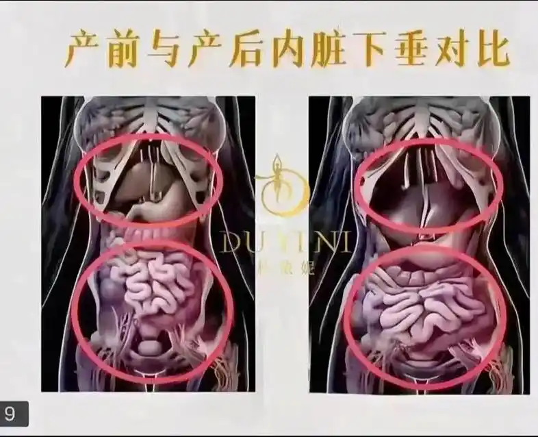 产后宝妈生完孩子一个就开始打造身材,这个变化直接换了一个人, - 抖